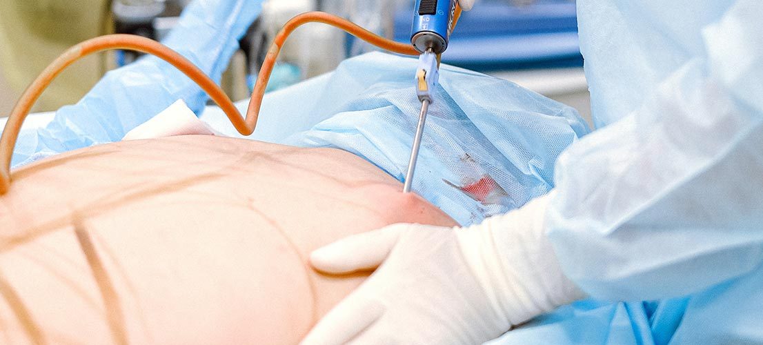 Gastroenterology Laparoscopic Surgeons