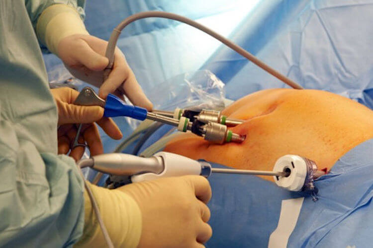 Gastroenterology Surgery Doctors