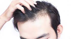 Hair Loss Treatment Services